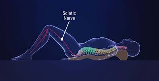 Sciatic Nerve Pain: Causes and Treatment